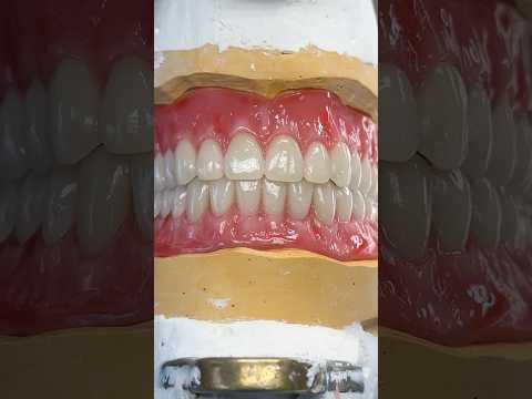 Stunning Wax Try-In #lsk121shorts #dentist #teeth