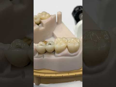 Zen Enamel Crowns and Implants #lsk121shorts #dentist #teeth