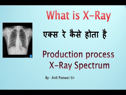 एक्स रे कैसे होता है  |What is X-Ray | Production process and types of spectrum