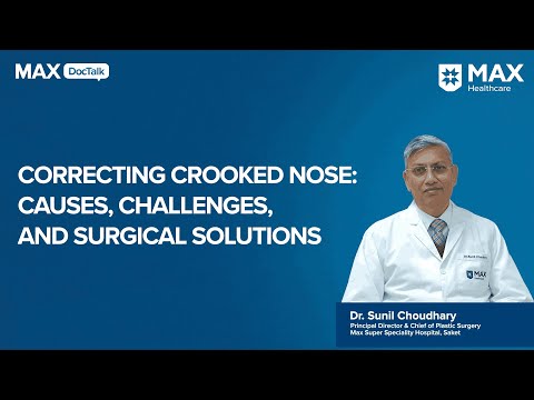 Correcting a Crooked Nose: Causes, Challenges & Surgical Solutions