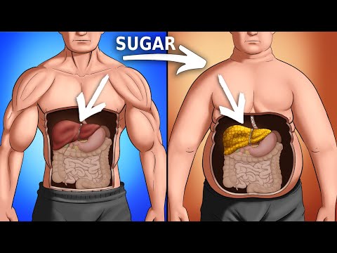 What Sugar Does To Your Body (Science-Based)