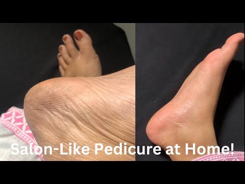 How to do Pedicure at Home|| Protouch Bliss Callus Remover Honest Review||