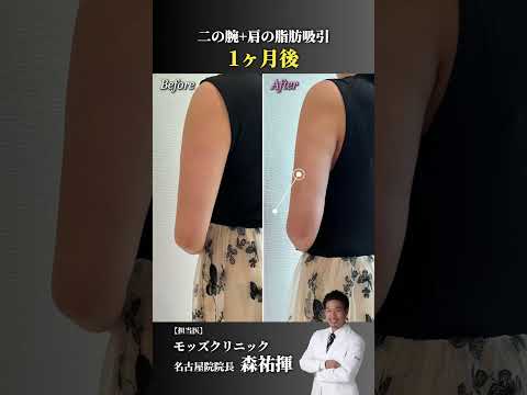 むちむち二の腕からの脱却 #shorts