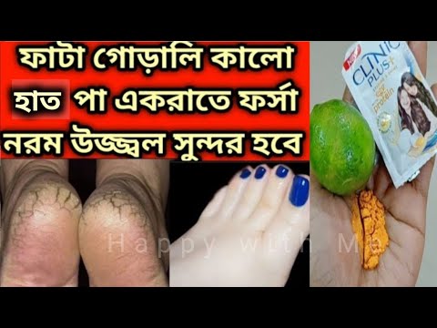 একদিনে ধবধবে ফর্সা করবে, কালো দাগ তুলে দেবে/D Tan facial at home/pedicure at home/Handcare