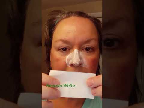 Tired of Blackheads? Me Too!