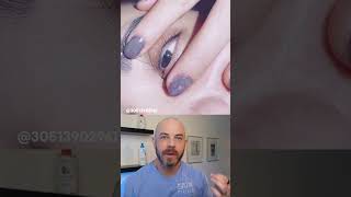 Derm reacts to super strange tear duct hair! #hairremoval #dermreacts #doctorreacts