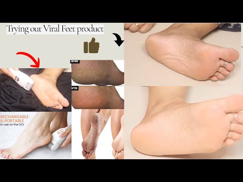 Trying Out Viral Feet Product | Callus Remover By PROTOUCH | Poojaglamourholic