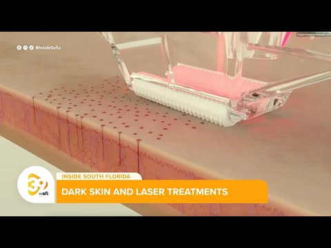 Winter Skin Care Tips and Laser Treatment Insights from Dr. Nkem Ugonabo