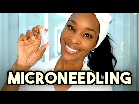 Microneedling: What you need to know, from a dermatologist and Skin of color Expert