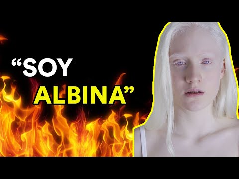 LIVING WITH ALBINISM