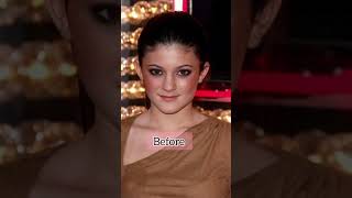 kaylie jenner Transformation #kyliejenner#surgery##glamup#tranding#kyliecosmetics#plasticsurgery