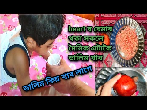 শিশুক ডালিম কেনেদৰে খোৱাব//ডালিমৰ🥤 কেনেদৰে বনাব//