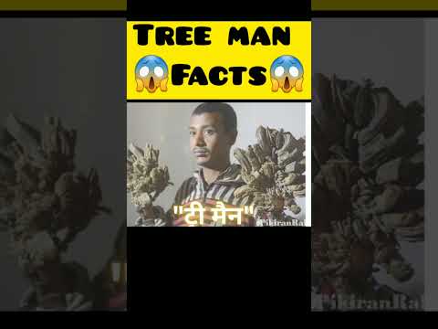 Tree man  के बारे में कुछ रोचक जानकारियां #viral #shorts #india #trending