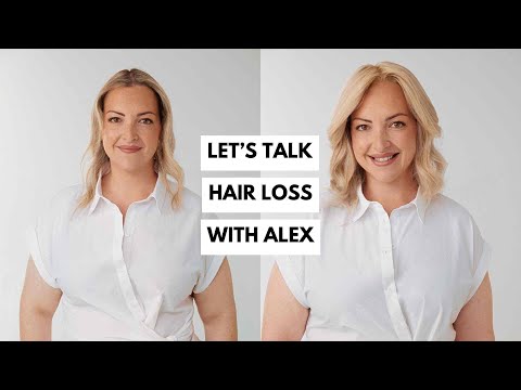 Let's talk hair loss with ✨Alex✨