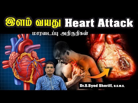 இளம் வயதில் வரும் Heart Attack | மாரடைப்புக்கான முக்கிய காரணங்கள் | Madurai Dr.S.Syed Sheriff