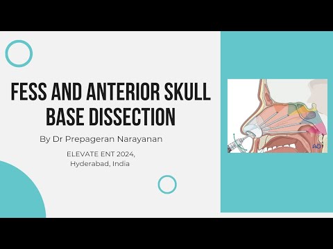 Anterior skull base cadaver dissection by Dr Prepageran Narayanan