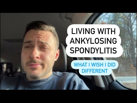 My Struggles as a Personal Trainer Living With Ankylosing Spondylitis