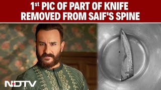 Saif Ali Khan News | Saif Ali Khan Stabbed | 1st Pic Of Part Of Knife Removed From Saif's Spine