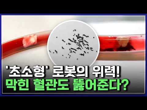 '초소형' 로봇의 위력! 막힌 혈관도 뚫어준다? | 브라보 K-사이언티스트 [반복재생]/YTN 사이언스