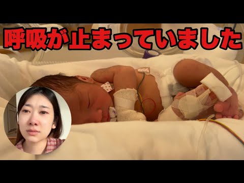 【新生児】生後35時間で無呼吸発作、NICUに入院/乳幼児突然死症候群