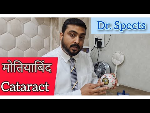 safed motiabind । How and why it happens and treatment । cataract