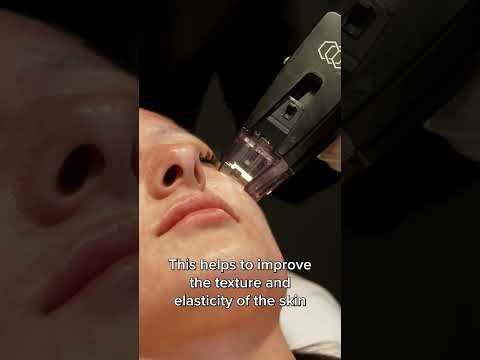 Morpheus8 RF Microneedling #skincare #morpheus8