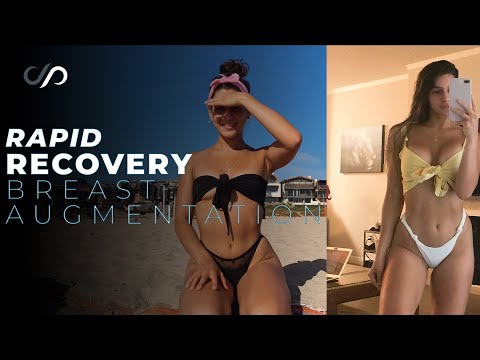 I Got a Breast Augmentation Surgery and Here's What Happened