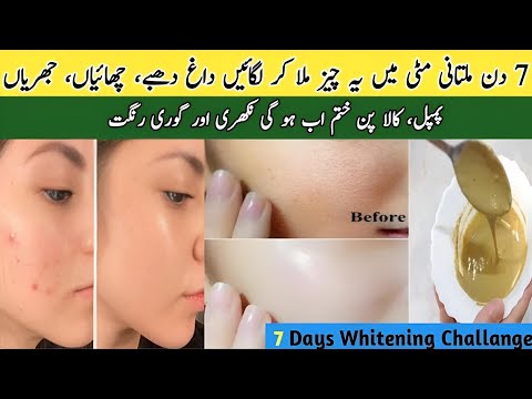 Multani Mitti Face Pack | Multani Mitti Face Pack For Glass Skin | Best Face Pack For Acne Free Face