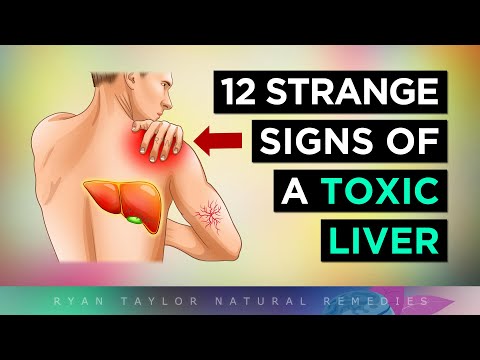 12 Strange Signs Your LIVER Is TOXIC