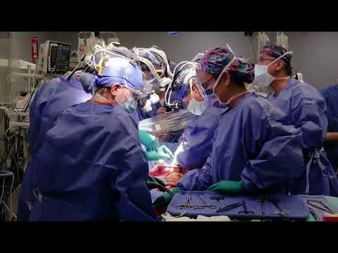 A Second Successful Pig Heart Transplant is Performed at the University of Maryland Medical Center