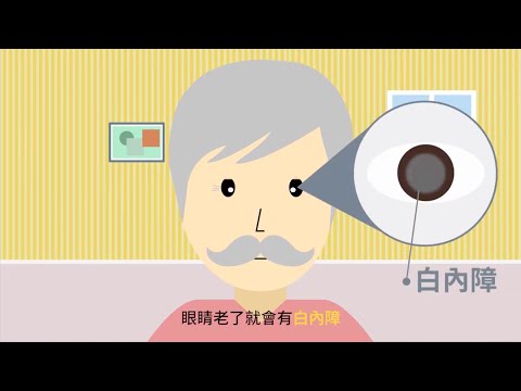 【動畫】你我都有可能遇上的老化病：「白內障」該如何被治療？