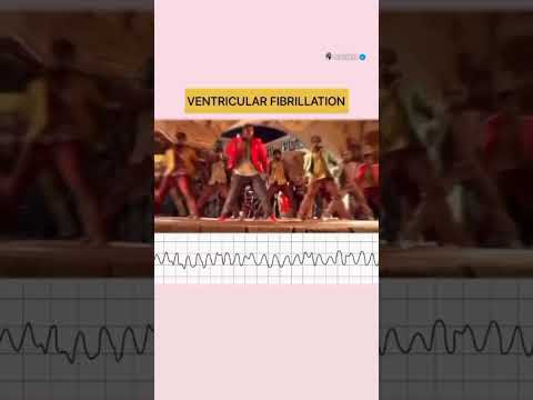 #medical #medicine #ecg