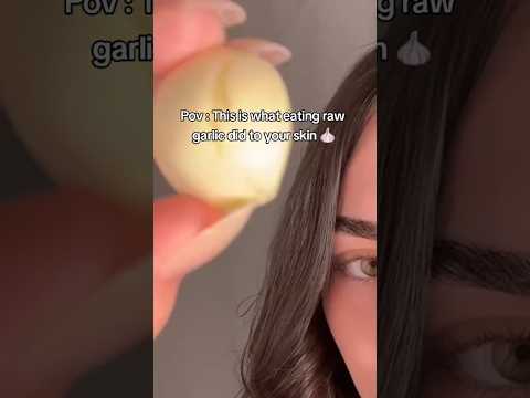 Eating garlic for 1 week | raw garlic challenge 🧄 #glowup #skincare #diyglow #beauty #acne #shorts