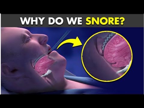 WHY DO WE SNORE? || Medical information || medical Students