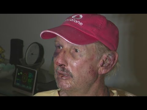 73-year-old man beaten in home invasion said he's lucky to be alive