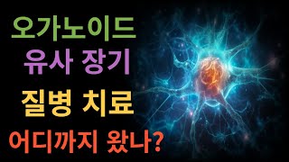 오가노이드 질병 치료 어디까지 왔나?  How far has organoid disease treatment come?