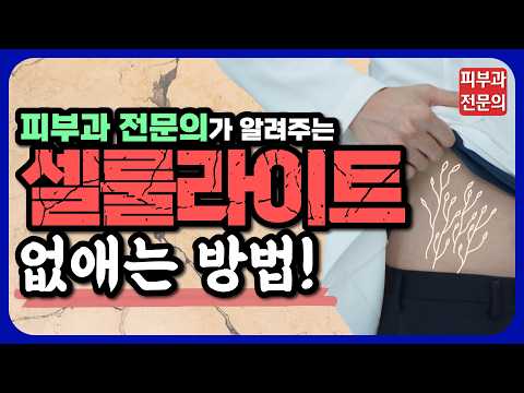 셀룰라이트 집에서 없애는 방법! - 튼살 차이점과 예방법까지 알려드립니다! 정말 쉽습니다!