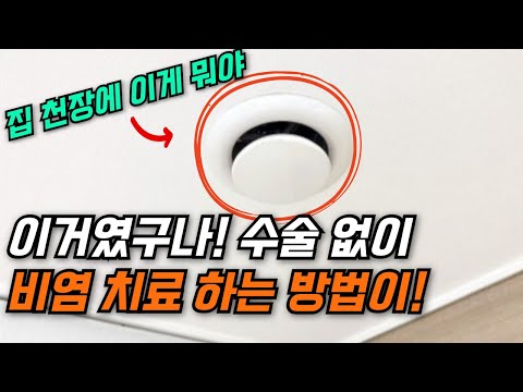 비염 수술 고민? 이 방법으로 수술 없이 비염 해결! #전열교환기 #생활꿀팁 #공기청정기 #환기시스템 #비염치료 #비염