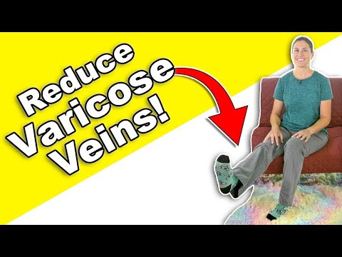 Reduce Varicose Veins with Stretches & Exercises