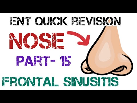 Frontal Sinusitis: Causes, Treatments, and Insights | Dr. Deen Lectures