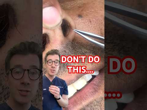 Doctor explains why you shouldn’t pluck NOSE HAIR #shorts #nosehair