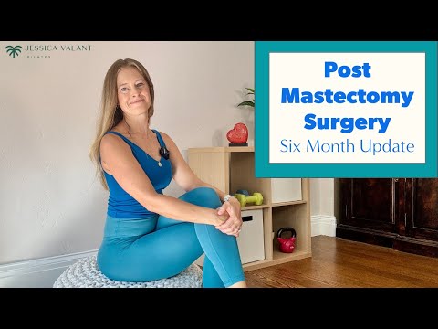 Mastectomy Surgery and Recovery - My Six Month Update