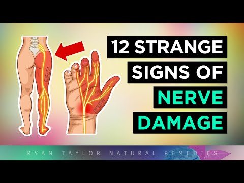 12 Weird Signs of NERVE Damage