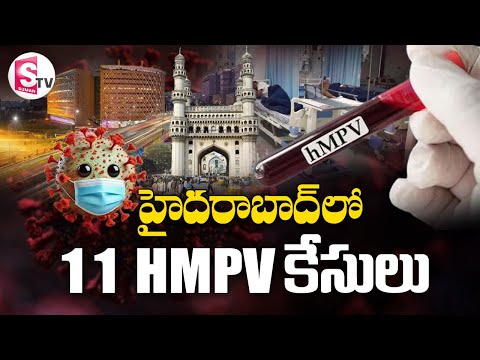 HMPV Cases in Hyderabad: హైదరాబాద్ లో HMPV కలకలం | HMPV Virus Latest Updates @SumanTVDwarakaTirumala