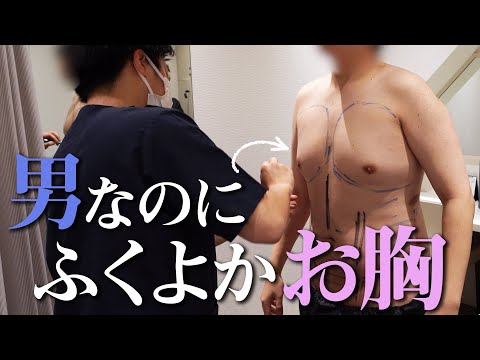 【男性脂肪吸引】お胸が膨らんで脂肪吸引した男性に半年間密着！【女性化乳房】 | モッズクリニック 森祐揮