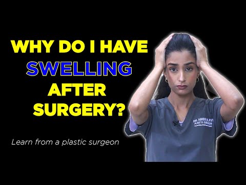 Is swelling after plastic surgery normal? How do you get rid of it?