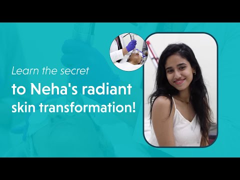 Get to know about Neha's Game Changing Journey to Flawless Skin with Oliva's Pigmentation Treatment.