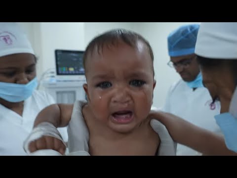 Cute Baby Cries Before Anesthesia for Surgery | Emotional Moment