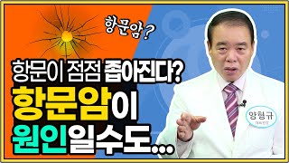 항문이 좁아지는 항문협착증! 간단한 수술법으로 치료가능!! 강동구 치질수술, 강동구 거상치질수술, 강동구 치질병원, 거상치질수술