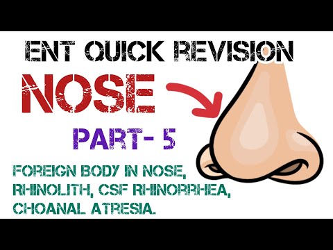 Nasal Foreign Bodies, Rhinoliths, and CSF Rhinorrhea Explained by Dr. Deen